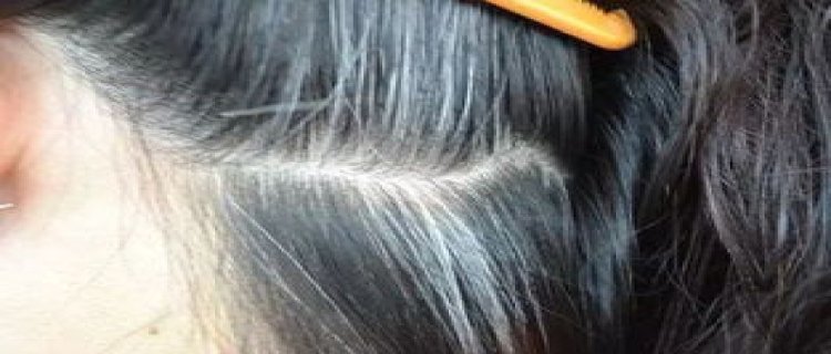 不同部位的白发该如何进行调理 白发变黑发有什么好方法